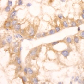 PRDX4 Rabbit Polyclonal Antibody