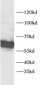 P4HA1 Rabbit Polyclonal Antibody