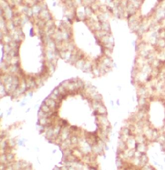 P4HA1 Rabbit Polyclonal Antibody