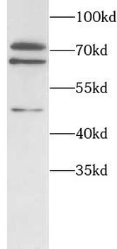 ITK Rabbit Polyclonal Antibody