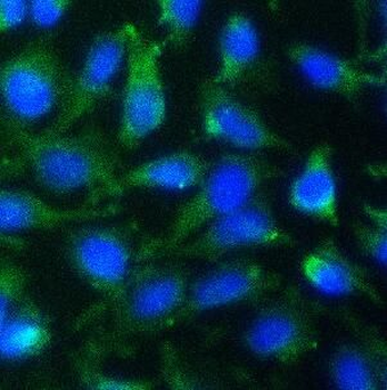HMGB1 Mouse Monoclonal Antibody