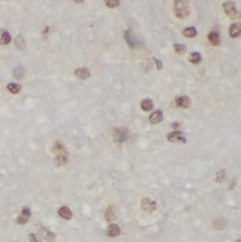 HMGB1 Mouse Monoclonal Antibody
