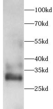 GALC Antibody