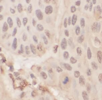 KRT1 Rabbit Polyclonal Antibody