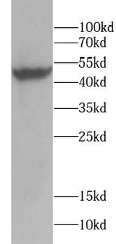 CYP24A1 Antibody