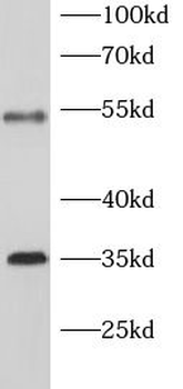 SLC7A11 Rabbit Polyclonal Antibody