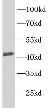 CCR2 Antibody