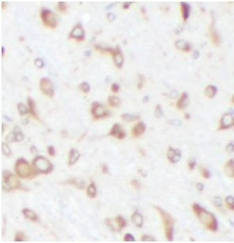 CPT1C Rabbit Polyclonal Antibody