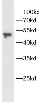 TMEM119 Rabbit Polyclonal Antibody