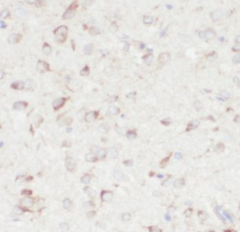 TMEM119 Rabbit Polyclonal Antibody