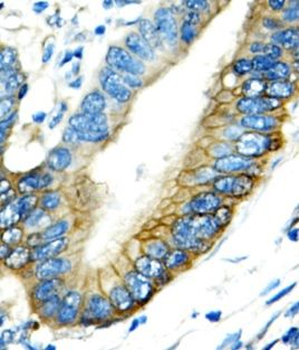 LILRB4 Rabbit Polyclonal Antibody