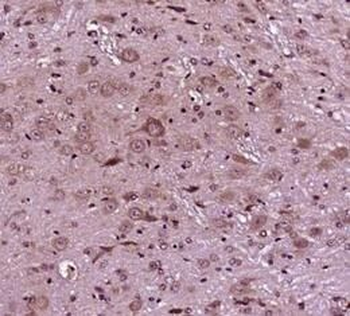 TNFRSF25 Rabbit Polyclonal Antibody