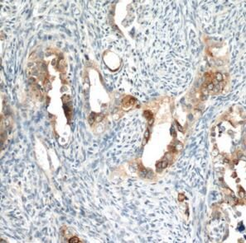 WFDC2 Mouse Monoclonal Antibody