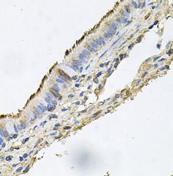 DSG1 Rabbit Polyclonal Antibody