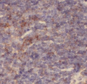 CHAF1B Antibody