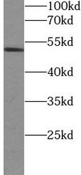Phospho GSK3B Mouse Monoclonal Antibody