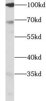 SLC40A1 Rabbit Polyclonal Antibody