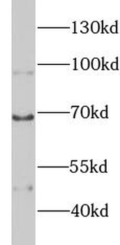KNG1 Rabbit Polyclonal Antibody