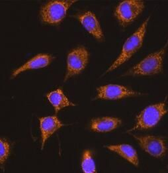 KNG1 Rabbit Polyclonal Antibody
