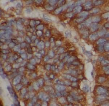 HSPA5 Mouse Monoclonal Antibody