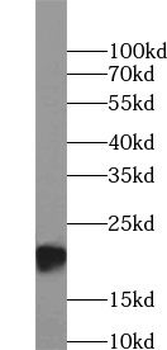 GPX2 Rabbit Polyclonal Antibody