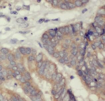 GPX2 Rabbit Polyclonal Antibody