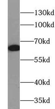 Pan AKT Rabbit Polyclonal Antibody