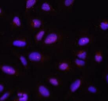 Pan AKT Rabbit Polyclonal Antibody