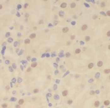 Pan AKT Rabbit Polyclonal Antibody