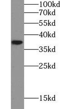 AKR1C2 Rabbit Polyclonal Antibody