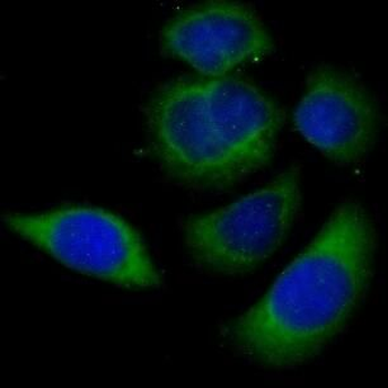 AKR1C2 Rabbit Polyclonal Antibody