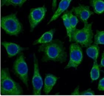 TSPO Rabbit Polyclonal Antibody