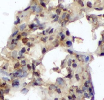 EIF5A Rabbit Polyclonal Antibody
