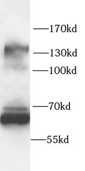 NFATC3 Rabbit Polyclonal Antibody