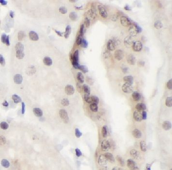 NFATC3 Rabbit Polyclonal Antibody