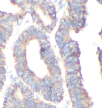 FOXO6 Rabbit Polyclonal Antibody