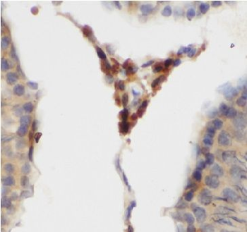 GPX4 Rabbit Polyclonal Antibody