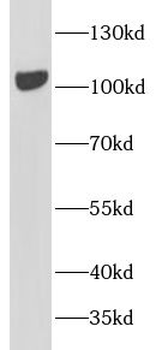 PTK2 Mouse Monoclonal Antibody