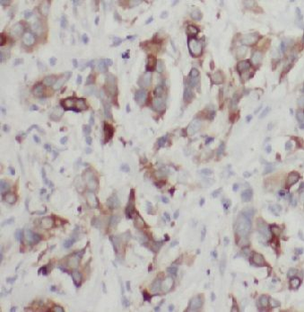 PTK2 Mouse Monoclonal Antibody
