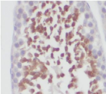 γ H2AX Rabbit Polyclonal Antibody