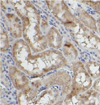 TAB3 Antibody