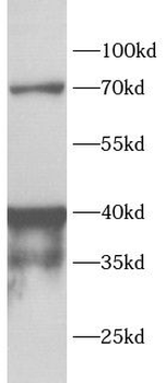 ADA Rabbit Polyclonal Antibody