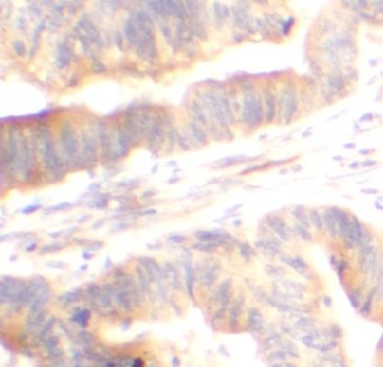 ADA Rabbit Polyclonal Antibody