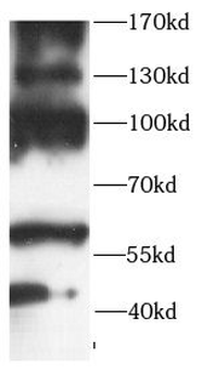 ENPP2 Rabbit Polyclonal Antibody