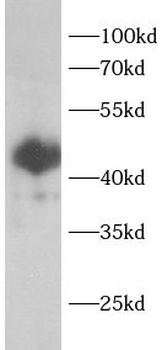 CAB39L Rabbit Polyclonal Antibody