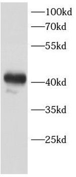 CAB39L Rabbit Polyclonal Antibody