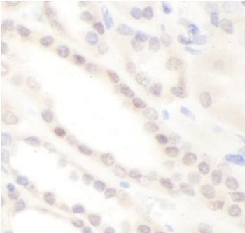 CAB39L Rabbit Polyclonal Antibody