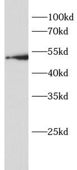 BACE1 Antibody