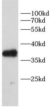 GREM1 Rabbit Polyclonal Antibody