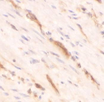 GREM1 Rabbit Polyclonal Antibody